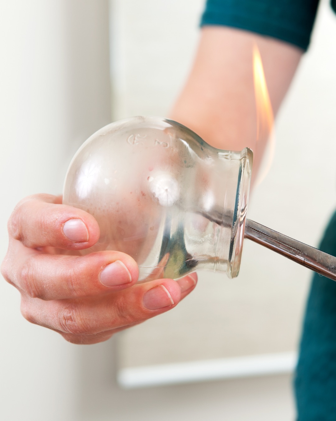 Préparation d’une ventouse en verre à l’aide d’une flamme pour une séance de cupping.